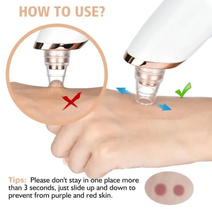 Acne Pore Cleaner & Black Head Remover
